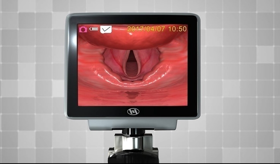 Ống soi thanh quản video sợi quang bằng nhựa kim loại HYHJ 1320 với lưỡi dao dùng một lần