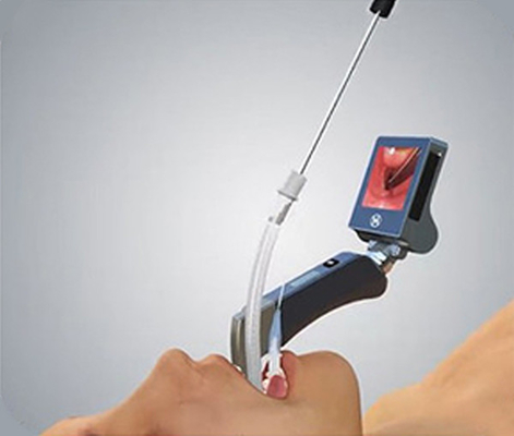 3-inch Full View Full View CMOS Video Laryngoscope với 5 kích thước Lưỡi dao có thể tái sử dụng