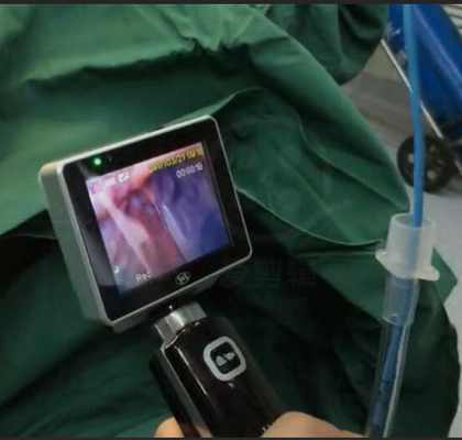 ICU EMS Ống soi thanh quản video sử dụng một lần với độ phân giải máy ảnh 1280 X 720