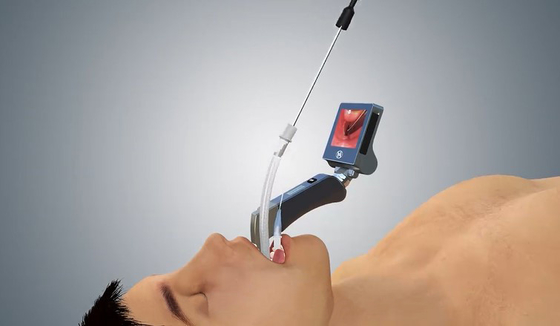 Khoa gây mê di động Haiye Video Laryngoscope 1060 Hpa