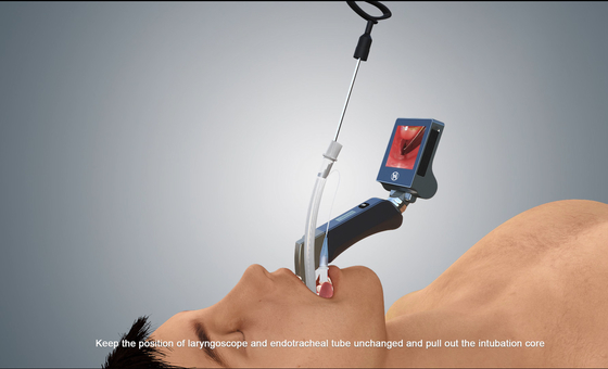 HD Máy soi thanh quản bằng video USB dành cho người lớn Nhi khoa Haiye Medical