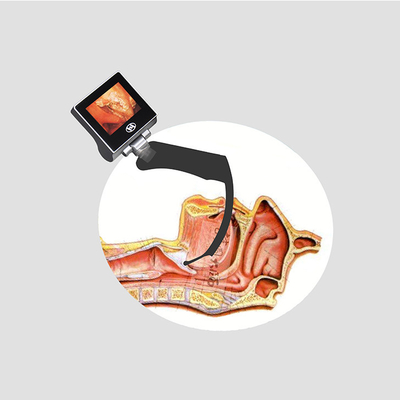 Ống soi thanh quản video cầm tay đặt nội khí quản với hình ảnh thanh quản 70 độ cách ly