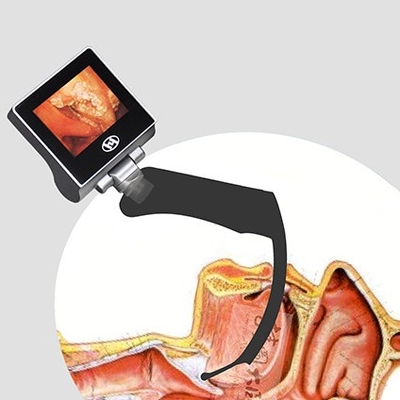 Máy soi thanh quản video gây mê tái sử dụng màn hình LCD 360 độ 2 triệu điểm ảnh