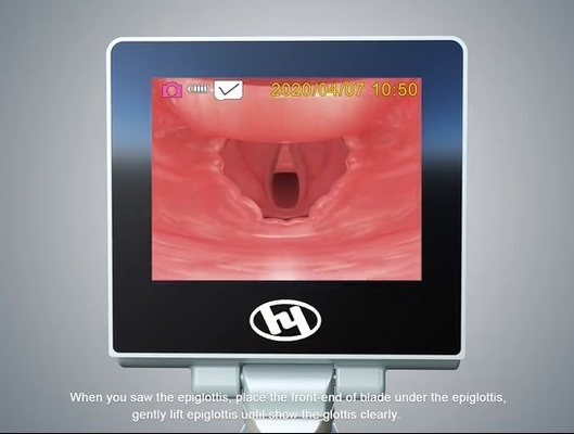 Xe cấp cứu Tai mũi họng Video gây mê cứng nhắc Ống soi thanh quản có lưỡi khó