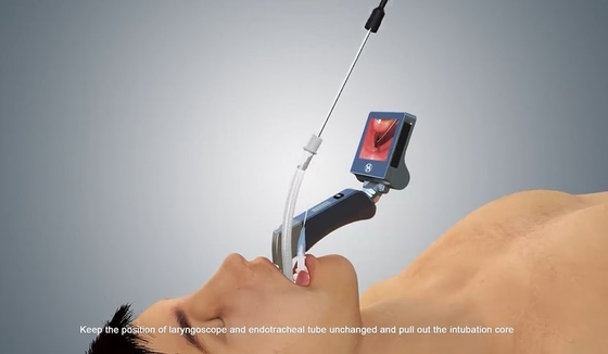 Ống soi thanh quản video có thể tái sử dụng có thể sạc lại để đặt nội khí quản gây mê y tế