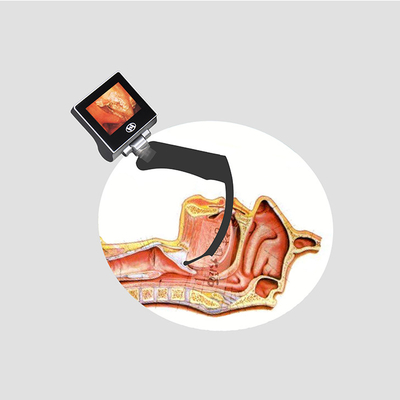 Đầu ra USB của ống soi thanh quản video Haiye di động 1280 * 720px